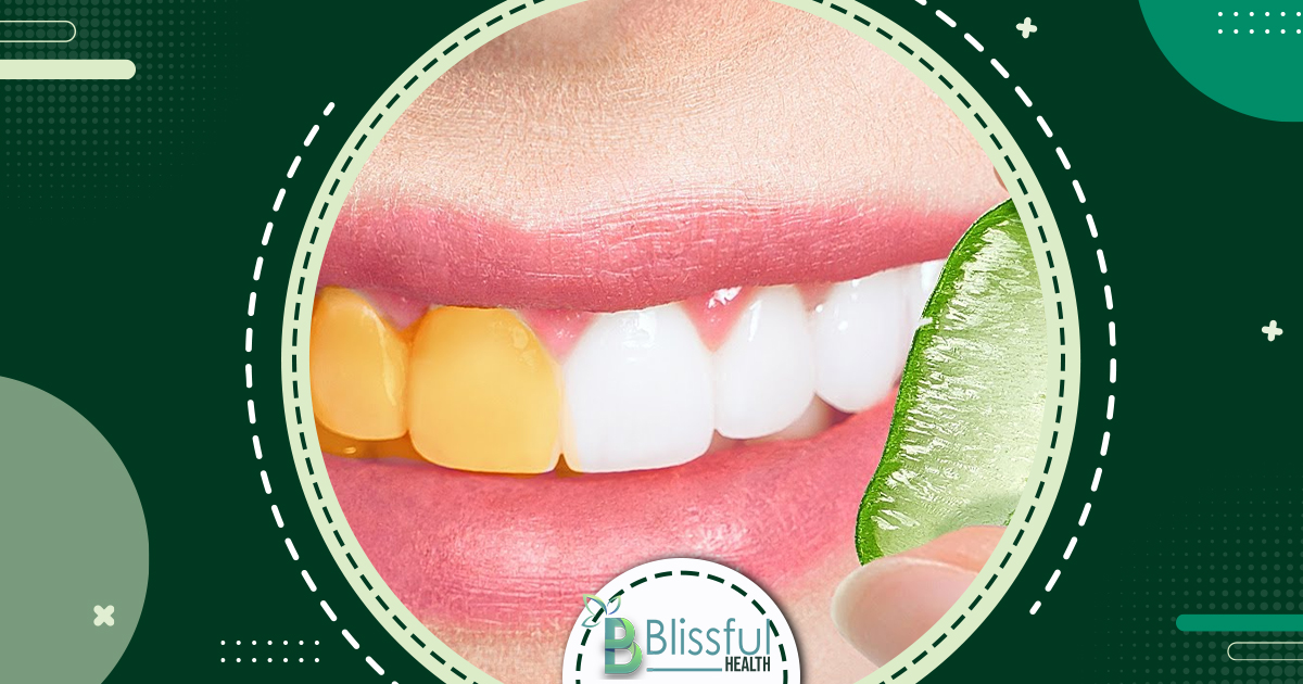 How To Prevent Tooth Decay: Top Natural Remedies and Care Tips